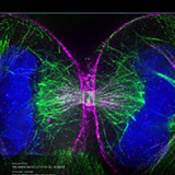 Life Sciences Education journal cover Cell Bio 2021 Image and Video Contest, American Society for Cell Biology. Dividing HeLaM cell, by Nadja Hümpfer.